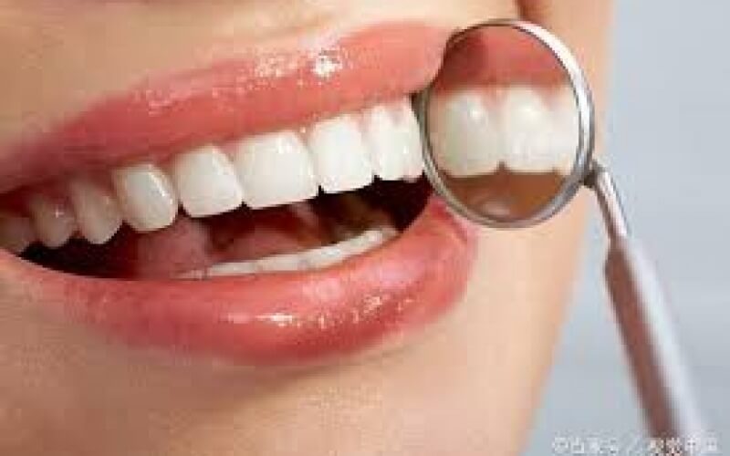 Diş dolgusu ne zaman değiştirilir? Diş dolgusunun ömrü ne kadardır?