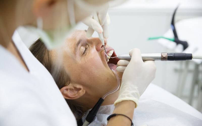 Periodontoloji Diş Taşı Temizliği Sonrası Yapılması Gerekenler